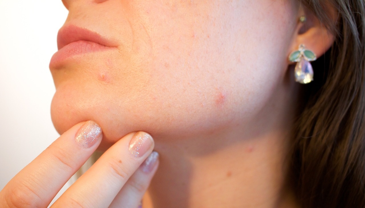 Comment utiliser l&rsquo;aloe vera pour apaiser la peau
